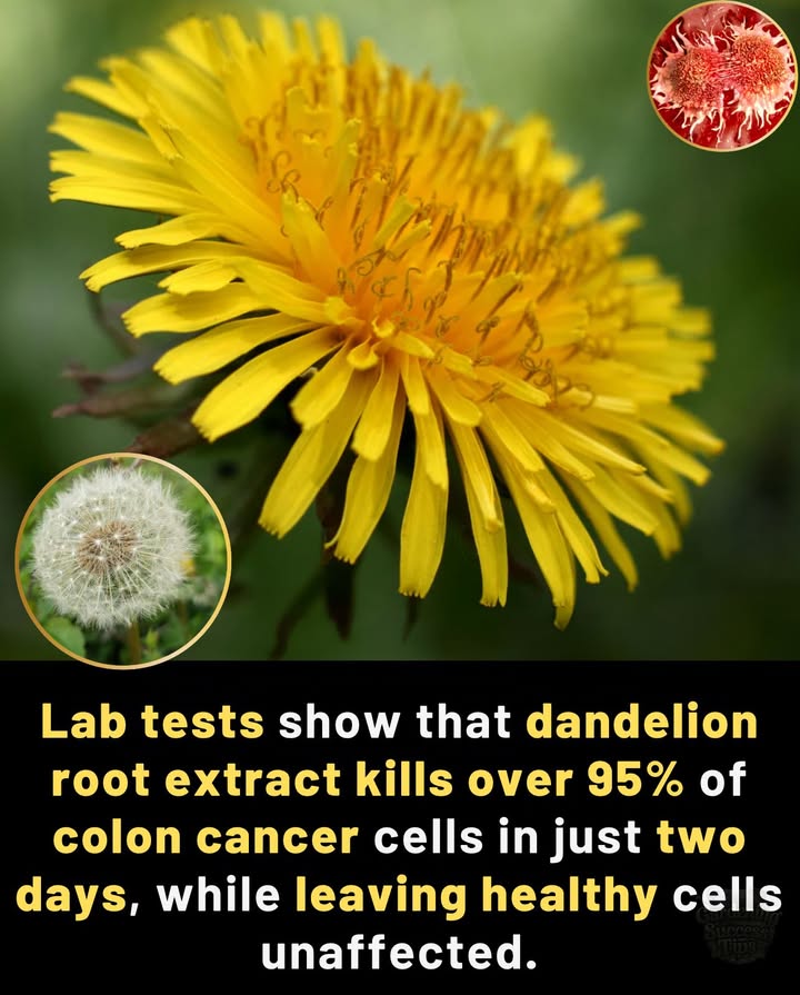 Fascinating research from Canadian scientists shows that dandelion root extract DRE killed over 95% of colon cancer cells in lab conditionswithout harming healthy cells.
離 This study was done in vitro test tube and is still in early stages. Its not a proven treatment for humans.
易 Science is always evolving, and this opens doors for further research.

 Source: University of Windsor, published in Oncotarget 2016.
