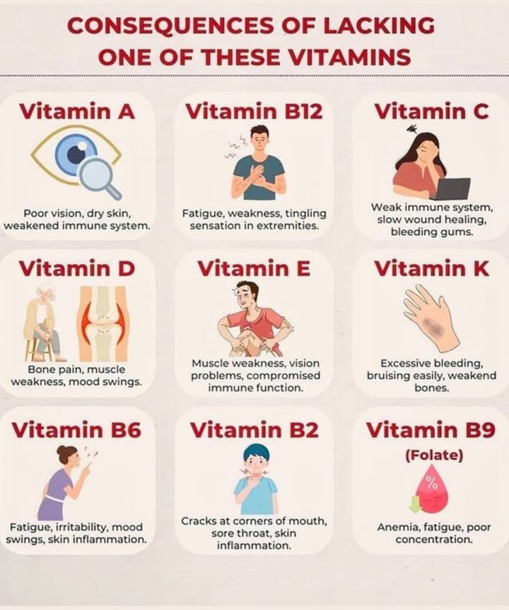 WHAT HAPPENS WHEN YOU LACK THESE VITAMINS?
 Vitamin Breakdown & Deficiency Signs:
凌 Vitamin A
Poor vision

Dry skin

Weak immunity

 Vitamin B12
Fatigue

Weakness

Tingling in hands & feet

 Vitamin C
Weak immune system

Slow wound healing

Bleeding gums

 Vitamin D
Bone or muscle pain

Mood swings

Muscle weakness

樂 Vitamin E
Muscle weakness

Vision issues

Low immune defense

領 Vitamin K
Easy bruising

Excessive bleeding

Weak bones

 Vitamin B6
Fatigue

Irritability

Skin inflammation

拏 Vitamin B2 Riboflavin
Cracked mouth corners

Sore throat

Skin issues

溺 Vitamin B9 Folate
Anemia

Fatigue

Poor focus

 TIP:
Balance your diet with colorful fruits, leafy greens, whole grains, and lean proteins. Consider a multivitamin if needed  but always check with your doctor first!