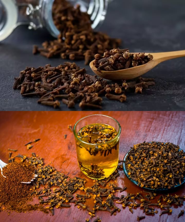 Agua de clavo: el poderoso remedio escondido en tu cocina
El clavo de olor, con su aroma cálido y especiado, no solo da sabor a tus platos: también puede transformarse en un remedio natural potente. El agua de clavo, obtenida al remojar o hervir clavos en agua, está cargada de antioxidantes, compuestos antiinflamatorios y agentes antibacterianos que revitalizan cuerpo y mente.

 30 beneficios del agua de clavo:
1 Mejora la digestión y reduce la hinchazón.
2 Alivia el dolor de muelas y calma las encías.
3 Refresca el aliento.
4 Refuerza el sistema inmunitario.
5 Reduce la inflamación articular.
6 Equilibra el azúcar en sangre.
7 Combate bacterias y hongos.
8 Favorece la salud del hígado.
9 Alivia la tos y limpia las vías respiratorias.
 Calma las náuseas y el malestar estomacal.
11 Mejora la salud de la piel y combate el acné.
12 Ayuda a controlar el peso y acelera el metabolismo.
13 Equilibra las hormonas.
14 Reduce los cólicos menstruales.
15 Aumenta la vitalidad y el deseo sexual.
16 Alivia dolores de cabeza.
17 Mejora la concentración y la claridad mental.
18 Reduce la fiebre y la inflamación.
19 Favorece la circulación sanguínea.
20 Previene el colesterol malo.
21 Desintoxica el organismo.
22 Combate el estrés oxidativo.
23 Aumenta la energía y la absorción de nutrientes.
24 Calma el dolor de garganta.
25 Estimula el crecimiento del cabello y reduce la caspa.
26 Fortalece los huesos.
27 Regula el apetito.
28 Combate infecciones urinarias.
29 Favorece la salud intestinal.
30 Apoya la salud cardiovascular.

 Cómo preparar agua de clavo:
Ingredientes:
 11,5 cucharaditas 1015 clavos
 1 taza 250 ml de agua
Preparación:
1 Hierve el agua y añade los clavos.
2 Cocina a fuego lento 57 min.
3 Tapa y deja reposar 10 min más.
4 Cuela, guarda en vidrio y deja enfriar.
 Se conserva hasta 2 días en nevera.

 Usos recomendados:
 En ayunas:  taza para estimular digestión y desintoxicar.
 Enjuague bucal: para mal aliento o dolor de garganta.
 Tónico facial: sobre piel limpia para reducir acné.
 En el cabello: enjuague fortalecedor y anticaspa.
 Durante el periodo: 1 taza tibia para aliviar cólicos.
 Con resfriado: sorbos pequeños varias veces al día.

 Precauciones:
El uso moderado es seguro. Evita excesos si estás embarazada, tienes úlceras o tomas anticoagulantes. Consulta a un profesional antes de usarla con frecuencia.

 Conclusión:
El agua de clavo es una infusión simple y poderosa, capaz de reforzar la salud desde dentro y cuidar la piel y el cabello desde fuera. Una pequeña dosis diaria puede marcar una gran diferencia en tu bienestar natural.