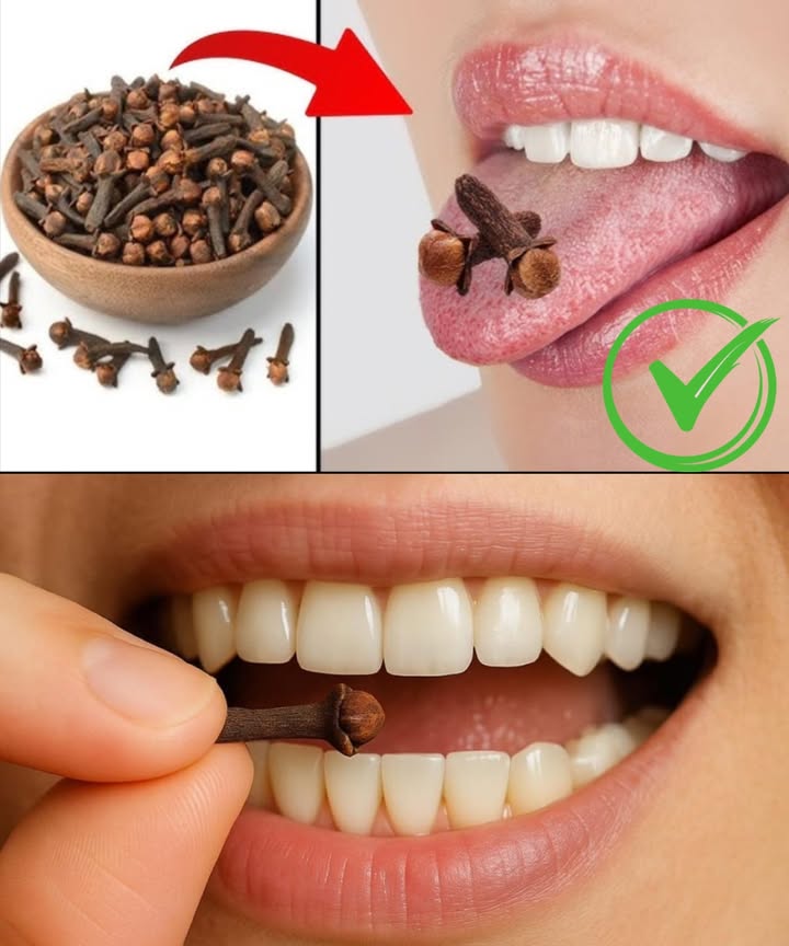 Masticar clavo diariamente: un hábito poderoso en un pequeño gesto 

Los clavos de olor son más que un simple condimento; son una auténtica farmacia natural en miniatura. Al masticar uno o dos al día, liberas eugenol, un compuesto con efectos significativos para tu salud desde el primer contacto en la boca.

 Alivio dental inmediato: combate infecciones, calma el dolor y deja el aliento fresco  
 Digestión sin molestias: estimula enzimas, reduce gases e hinchazón  
 Limpieza del hígado: rico en antioxidantes que desinflaman y purifican  
 Control del azúcar: mejora la sensibilidad a la insulina  
 Escudo contra el cáncer: flavonoides que protegen el ADN  
 Sistema inmune fortalecido: combate microbios y refuerza defensas  
 Respiración libre: abre las vías respiratorias y alivia la congestión  
 Corazón protegido: reduce el colesterol LDL y mejora la circulación  
 Estómago a salvo: previene úlceras reforzando la mucosa gástrica  
 Adiós parásitos: interrumpe el ciclo de los intestinales  
 Mente serena: disminuye el estrés regulando serotonina y dopamina  

 Cómo hacerlo correctamente:  
 Mastica 1 o 2 clavos enteros al día, lentamente  
 Hazlo por la mañana o después de comer  
 Elige clavo entero, marrón oscuro, de aroma intenso y orgánico  

 Evita si estás embarazada, tomas anticoagulantes, eres alérgico al clavo o se trata de niños pequeños.  

Un gesto mínimo, un impacto máximo. Una especia ancestral que cuida tu cuerpo desde dentro, solo con masticar.