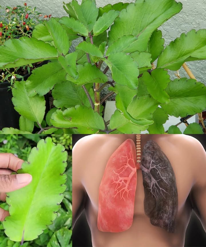 Hoja de Vida: la planta curativa que crece en tu jardín 

Conocida como Hoja de la Vida Kalanchoe pinnata, esta suculenta milagrosa desarrolla pequeñas plantitas en los bordes de sus hojas y es un verdadero tesoro medicinal oculto a simple vista. Utilizada durante siglos en la medicina tradicional, también recibe nombres como Planta de Goethe o Planta del Aire.

 20 poderosos beneficios naturales
 Alivia la tos y elimina mucosidad.
 Disuelve cálculos renales y mejora la salud urinaria.
 Reduce los síntomas del asma y limpia los bronquios.
 Acelera la cicatrización de heridas y quemaduras.
 Disminuye la inflamación y el dolor.
 Refuerza el sistema inmunológico.
 Baja la fiebre de forma natural.
 Mejora la digestión y alivia el estreñimiento.
 Calma los dolores de cabeza.
 Combate infecciones bacterianas y fúngicas.
 Protege y desintoxica el hígado.
 Alivia picaduras de insectos y reduce la hinchazón.
 Mejora la salud bucal y las encías.
 Equilibra la presión arterial.
 Regula el ciclo menstrual y alivia cólicos.
 Favorece el sueño y la relajación.
 Cuida la piel y reduce el acné.
 Protege el estómago y ayuda con las úlceras.
 Calma la diarrea y molestias intestinales.
 Alivia el dolor articular y muscular.

 Formas sencillas de usarla en casa

 Té de hojas  Ideal para tos, fiebre, digestión o defensas.
Hierve 23 hojas en 2 tazas de agua durante 10 minutos. Cuela y bebe tibio una o dos veces al día.

磻 Jugo fresco  Refuerza el hígado, el sistema respiratorio y el equilibrio hormonal.
Licúa 23 hojas con  taza de agua, cuela y toma 1 cucharada con el estómago vacío.

 Cataplasma  Perfecta para heridas, inflamación o dolor articular.
Tritura las hojas, aplica la pasta sobre la zona afectada, cubre con gasa y deja actuar 30 minutos.

 Inhalación de vapor  Despeja bronquios y senos nasales.
Hierve un puñado de hojas, cubre la cabeza con una toalla e inhala el vapor 510 minutos.

瘟 Enjuague bucal  Para llagas, encías y garganta.
Prepara un té suave, deja enfriar y haz gárgaras varias veces al día.

 Mascarilla facial  Suaviza y purifica la piel.
Mezcla pulpa de hoja con miel o aloe, aplica 15 minutos y enjuaga.

 Mezcla nocturna  Para dormir mejor.
Disuelve 1 cucharadita de jugo en agua tibia con miel y bébelo antes de acostarte.

 Precaución
Uso externo y en pequeñas dosis internas tradicionales. Consulta a un médico antes de usar si estás embarazada, lactando o bajo tratamiento. Evita el consumo prolongado sin supervisión profesional.

 La Hoja de la Vida es mucho más que una planta decorativa: es un símbolo de sabiduría natural y curación ancestral que florece silenciosamente en tu jardín.