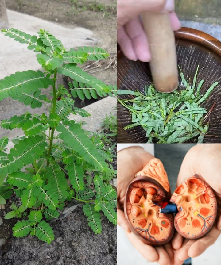 La planta trituradora: el remedio natural para los cálculos renales

El Phyllanthus niruri, conocido como Rompepiedras, es una hierba ancestral famosa por su habilidad para descomponer y prevenir los cálculos renales, aliviando las molestias y promoviendo la salud del tracto urinario.

 Por qué se le llama Rompepiedras?
 Disuelve cálculos: compuestos como la filantina debilitan los cristales de oxalato de calcio.
 Acción diurética: incrementa la producción de orina y facilita la expulsión de pequeños cálculos.
 Antiinflamatorio: calma el tracto urinario y reduce las molestias.
 Preventivo: ayuda a prevenir la formación de nuevos cálculos.

 Cómo usar el Phyllanthus niruri?

1 Té de hierbas
 1 cdta. de hojas secas  1 taza de agua
 Hervir durante 10 min, colar y beber
 Consumir 23 tazas al día durante 2 semanas

2 Jugo fresco
 Licuar un puñado de hojas con  taza de agua
 Colar y beber 1 cda. dos veces al día

3 Polvo casero
 Secar hojas y tallos, y moler hasta obtener un polvo fino
 Tomar 1 cdta. mezclada con agua, té o jugo, 1 vez al día

 Precauciones
 Consultar a un médico si está embarazada, amamantando o tomando medicamentos.
 No exceder la dosis: es un diurético potente.
 Mantenerse bien hidratado durante el día.

 El Rompepiedras es un aliado natural, eficaz y seguro cuando se usa con moderación para mantener la salud renal y prevenir cálculos de manera tradicional