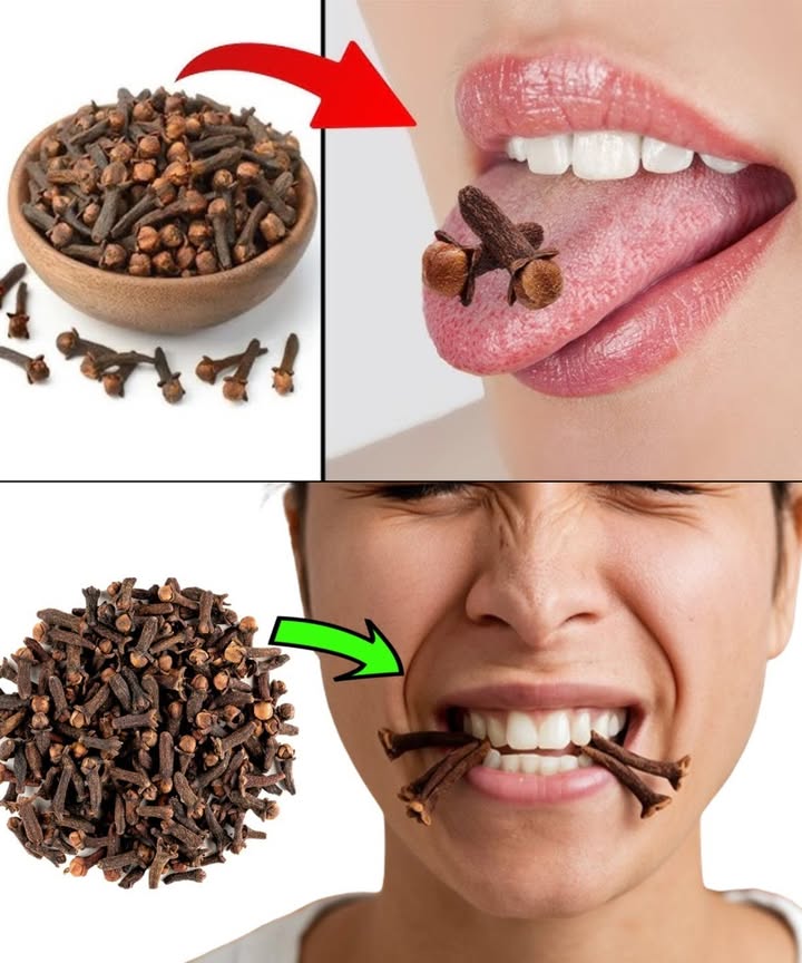 Masticar clavo a diario: un hábito poderoso en un pequeño gesto

Los clavos de olor, más que un simple condimento, esconden una farmacia natural en miniatura. Al masticar uno o dos al día, liberas compuestos como el eugenol, que actúan directamente en tu cuerpo desde la boca.

 Alivio dental inmediato: combate infecciones bucales, calma el dolor y deja el aliento fresco.
 Digestión sin molestias: estimula enzimas, reduce gases e hinchazón.
 Limpieza del hígado: rico en antioxidantes que desinflaman y ayudan a depurar.
 Azúcar bajo control: mejora la sensibilidad a la insulina.
 Escudo anticáncer: contiene flavonoides que protegen tu ADN.
 Sistema inmune más fuerte: combate microbios y aumenta tus defensas.
 Respiración libre: abre las vías respiratorias y alivia la congestión.
 Corazón protegido: reduce el colesterol malo y mejora la circulación.
 Estómago a salvo: previene úlceras reforzando la mucosa gástrica.
 Adiós parásitos: rompe el ciclo de los intestinales.
 Mente serena: reduce el estrés al influir sobre serotonina y dopamina.

 Cómo hacerlo bien
 Mastica 1 o 2 clavos enteros al día, lentamente.
 Hazlo por la mañana o tras comer.
 Elige clavo entero, marrón intenso, de aroma fuerte y orgánico.

 Evita si estás embarazada, tomas anticoagulantes, tienes alergia al clavo o lo das a niños pequeños.

Un gesto mínimo, un impacto máximo: una especia ancestral que cuida tu cuerpo desde dentro, con solo masticar.