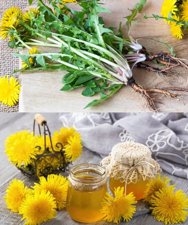 Diente de león: el tesoro escondido de la naturaleza 

 Beneficios impresionantes
 Antioxidante natural que combate el envejecimiento
 Refuerza el sistema inmunológico
 Mejora la digestión y reduce inflamación
 Limpia el hígado de forma natural
 Diurético suave que reduce la retención de líquidos
 Regula los niveles de azúcar en sangre
 Favorece la salud renal y urinaria
 Apoya la pérdida de peso
 Fuente rica en vitaminas A, C y K
 Mejora la piel y ayuda contra el acné
 Fortalece huesos y dientes
 Alivia inflamación y dolor articular
 Ayuda contra la anemia y equilibra hormonas
 Promueve un cabello fuerte y brillante
 Protege la vista y la memoria
 Apoya la salud cardíaca y reduce colesterol
 Potencial anticancerígeno
 Calma eccemas y psoriasis
 Favorece un metabolismo activo
 Previene cálculos renales y biliares

 Cómo usarlo
 Hojas: crudas en ensaladas o en infusiones
 Flores: para té, aceites o vino casero
 Raíces: tostadas para café herbal o en tintura medicinal

 Precaución
Consulta con un profesional si tomas medicamentos o tienes problemas de vesícula

 Una planta humilde con poderes extraordinarios. Inclúyela en tu rutina y transforma tu bienestar desde la raíz.