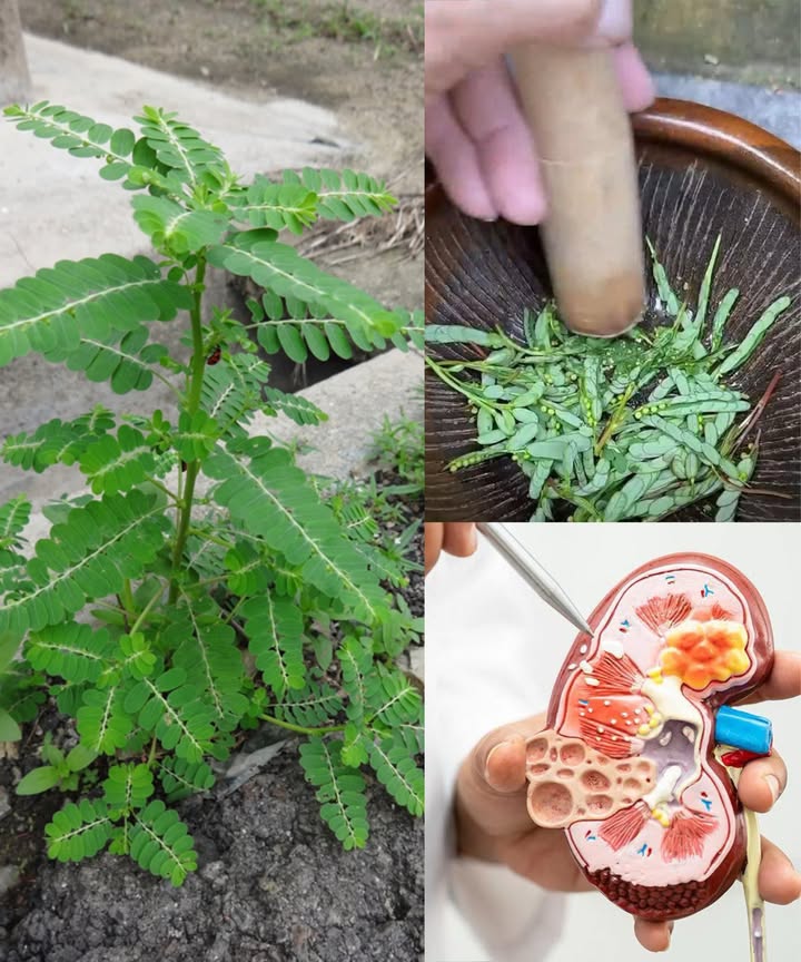 La planta trituradora: el remedio natural contra los cálculos renales

El Phyllanthus niruri, conocido como Rompepiedras, es una hierba ancestral reconocida por su capacidad para descomponer y prevenir cálculos renales, aliviando molestias y apoyando la salud del tracto urinario.

 Por qué se llama Rompepiedras
 Disuelve cálculos: compuestos como la filantina debilitan cristales de oxalato de calcio
 Acción diurética: aumenta la producción de orina y facilita la expulsión de cálculos pequeños
 Antiinflamatorio: calma el tracto urinario y reduce molestias
 Preventivo: ayuda a evitar la formación de nuevos cálculos

 Cómo usar el Phyllanthus niruri

1 Té de hierbas
 1 cdta. de hojas secas  1 taza de agua
 Hervir 10 min, colar y beber
 Tomar 23 tazas al día por 2 semanas

2 Jugo fresco
 Licuar un puñado de hojas con  taza de agua
 Colar y beber 1 cda. dos veces al día

3 Polvo casero
 Secar hojas y tallos, moler hasta polvo fino
 Tomar 1 cdta. mezclada con agua, té o jugo, 1 vez al día

 Precauciones
 Consultar al médico en embarazo, lactancia o si toma medicamentos
 No exceder dosis: es un diurético potente
 Mantenerse bien hidratado durante el día

 El Rompepiedras es un aliado natural, eficaz y seguro cuando se usa con moderación para mantener la salud renal y prevenir cálculos de manera tradicional