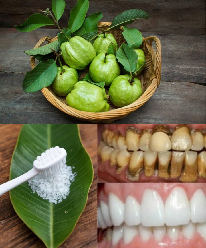 Hojas de guayaba: un remedio natural para dientes y encías 醴  

Las hojas de guayaba no son solo un recurso tradicional, también actúan como un aliado antibacteriano, antiinflamatorio y refrescante para tu salud bucal. Aquí te presentamos 3 formas sencillas y económicas de aprovechar sus beneficios:  

1 Masticar hojas frescas  
 Selecciona 23 hojas tiernas y limpias  
 Mastícalas lentamente durante unos minutos  
 Alivian el dolor, reducen la inflamación y refrescan el aliento  
2 Enjuague bucal casero  
 Hierve 57 hojas en 1 taza de agua durante 10 minutos  
 Cuela la mezcla y deja enfriar  
 Utiliza como enjuague 12 veces al día  
 Disminuye la placa, combate bacterias y calma las encías  
3 Pasta con hojas y sal  
 Machaca hojas frescas hasta hacer una pasta  
 Añade una pizca de sal  
 Aplica en el diente o encías por 5 minutos y enjuaga  
 Antibacteriano, limpia y reduce la sensibilidad  

 Las hojas de guayaba no sustituyen al dentista, pero complementan tu cuidado diario junto con el cepillado y la higiene regular.
