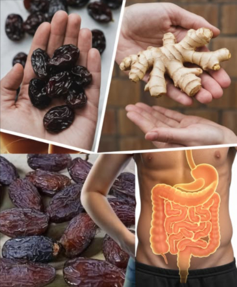 La muerte empieza en los intestinos. Gases estomacales.
Hígado graso.
Limpieza intestinal. Medicina natural.
Sólo los miembros educados dan las gracias.
Método en el primer comentario
La combinación de dátiles y jengibre no solo ofrece un sabor delicioso, sino también poderosos beneficios  medicinales. Conocidos por sus propiedades curativas, estos ingredientes han sido utilizados durante siglos para tratar una variedad de problemas de salud, incluyendo problemas intestinales, gases estomacales e hígado graso. En este artículo, exploraremos cómo preparar dos recetas efectivas con dátiles y jengibre, así como sus beneficios, propiedades, precauciones y modos de consumo. Acompáñanos a descubrir los secretos de esta  hierba sagrada y medicinal de África!
Receta 1: Infusión de dátiles y jengibre
Ingredientes:
5 dátiles deshuesados
1 trozo de jengibre fresco 3 cm
2 tazas de agua
1 cucharadita de miel opcional
Preparación:
Lava los dátiles y el jengibre con agua tibia para eliminar cualquier residuo.
Corta el jengibre en rodajas finas y agrégalo a una olla con 2 tazas de agua.
Lleva el agua a ebullición y cocina a fuego lento durante 10 minutos.
Agrega los dátiles deshuesados y cocina por 5 minutos más.
Cuela la infusión y endúlzala con miel si lo deseas.
Sirve caliente y disfruta.
Modo de consumo: Se recomienda consumir esta infusión dos veces al día, una por la mañana en ayunas y otra antes de dormir. Idealmente, durante un periodo de 15 días para obtener resultados óptimos.
Beneficios:
Alivia los gases estomacales al reducir la inflamación del tracto digestivo.
Mejora la digestión al estimular la producción de enzimas.
Desintoxica el hígado gracias a los antioxidantes presentes en el jengibre y los dátiles.
Reduce la acidez estomacal.
Promueve el equilibrio de la flora intestinal.
Combate el estreñimiento.
Mejora la circulación sanguínea.
Refuerza el sistema inmunológico.
Disminuye la sensación de pesadez después de las comidas.
Previene cólicos estomacales.
Protege las paredes del estómago.
Reduce el colesterol.
Alivia los síntomas del síndrome del intestino irritable.
Favorece la eliminación de toxinas.
Regula los niveles de glucosa en sangre.
Promueve la relajación muscular.
Combate los radicales libres.
Mejora la absorción de nutrientes.
Actúa como antiinflamatorio natural.
Protege contra infecciones bacterianas.
Alivia los mareos asociados a problemas digestivos.
Mejora la energía y vitalidad.
Reduce el riesgo de úlceras estomacales.
Mejora la calidad del sueño.
Favorece la pérdida de peso en programas de desintoxicación.