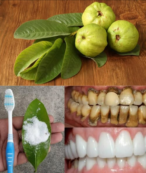 Hojas de guayaba: remedio natural para dientes y encías 醴
Las hojas de guayaba no solo son un recurso tradicional, también son un aliado antibacteriano, antiinflamatorio y refrescante para tu salud bucal. Aquí tienes 3 maneras sencillas y económicas de aprovecharlas:
1 Masticar hojas frescas
 Elige 23 hojas tiernas y limpias
 Mastícalas lentamente unos minutos
 Alivian el dolor, reducen la inflamación y refrescan el aliento
2 Enjuague bucal casero
 Hierve 57 hojas en 1 taza de agua por 10 min
 Cuela y deja enfriar
 Úsalo como enjuague 12 veces al día
 Disminuye placa, combate bacterias y calma las encías
3 Pasta con hojas y sal
 Machaca hojas frescas hasta obtener una pasta
 Añade una pizca de sal
 Aplica en el diente o encías por 5 min y enjuaga
 Antibacteriano, limpia y reduce sensibilidad
 Las hojas de guayaba no reemplazan al dentista, pero sí refuerzan tu cuidado diario junto al cepillado y la higiene regular.