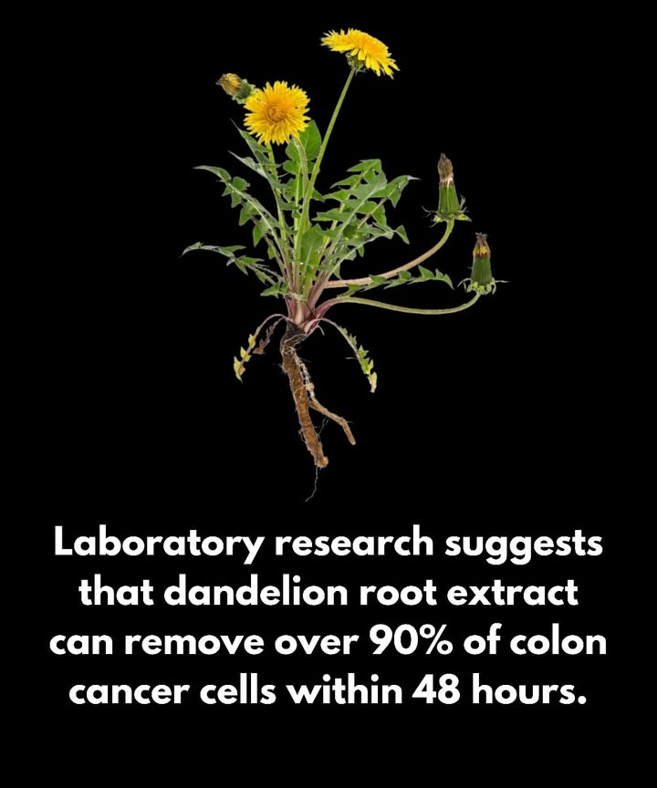 Laboratory studies have shown that dandelion root extract can destroy over 90% of colon cancer cells within 48 hours, while leaving healthy cells unharmed. The extract activates several cell-death pathways, even in cancers lacking the tumor-suppressor gene p53. In animal studies, it slows tumor growth without causing toxicity.

Dandelion root is also valued for supporting liver function, increasing bile flow up to fourfold, which helps improve fat metabolism. Its high potassium content contributes to better digestion, and it is often used as a natural coffee alternative. Additionally, it supports detoxification through the lymphatic system and the blood, making it useful for conditions such as acne, hormonal imbalances, constipation, and mental fatigue.

For tea preparation, 1 to 2 tea bags may be steeped in 8 ounces of boiling water, with milk or molasses added for taste if preferred. Alternatively, 4 to 5 tablespoons of raw or roasted dandelion root can be simmered in 1 quart of water for at least 20 minutes after boiling. Once strained, start with about 1/4 cup daily and gradually increase to 12 cups per day.