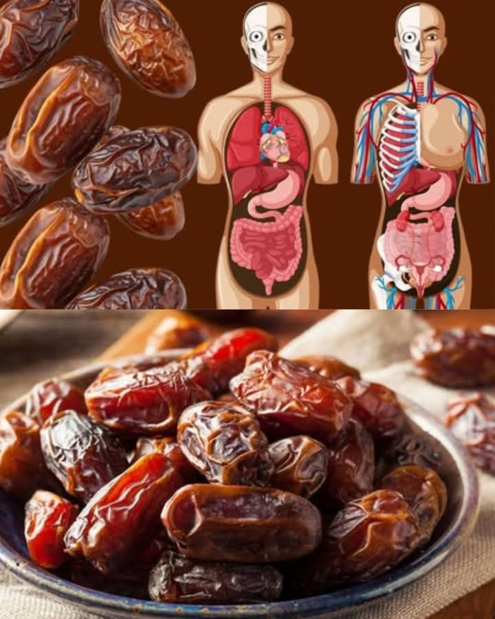 Das passiert mit Ihrem Körper, wenn Sie 3 Datteln pro Tag essen 

Diese süße, köstliche Frucht könnte eine der gesündesten der Welt sein. Schon drei Datteln am Tag reichen aus, um erstaunliche Vorteile zu spüren!

1 Schützt das Herz
Reich an Kalium helfen Datteln, den Cholesterinspiegel zu senken und Herzinfarkten vorzubeugen. 

2 Unterstützt die Leber
Sie regulieren die Leberfunktionen und können bestimmten Lebererkrankungen vorbeugen. 離

3 Verbessert Sehkraft und Haut
Dank Vitamin D tragen sie zu klarer Sicht und strahlender Haut bei. 

4 Natürlicher Energieschub
Eine Dattel, mit einer Nuss gefüllt, ist eine gesunde Alternative zu Energy-Drinks. 

5 Fördert die Verdauung
Ihr hoher Ballaststoffgehalt lindert Verstopfung und unterstützt eine gute Darmtätigkeit. 

6 Entzündungshemmend
Das enthaltene Magnesium hilft, Schwellungen zu reduzieren. 

7 Entgiftet den Körper
Reich an Antioxidantien unterstützen sie den Abbau von Toxinen und freien Radikalen. 

8 Stabilisiert den Blutzucker
Sie helfen, den Blutzuckerspiegel zu regulieren  ideal für Menschen mit Typ-2-Diabetes. 

9 Stärkt das Gehirn
Datteln können Gedächtnis und Konzentration verbessern. 易

 Kräftigt die Knochen
Kalium und andere Mineralstoffe tragen zu einer höheren Knochendichte bei. 領