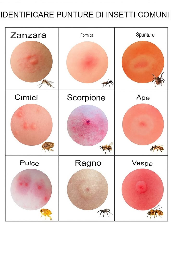 Wachsen  Insektenstiche erkennen für schnelle Hilfe und innere Ruhe 烈
Insektenstiche sehen unterschiedlich aus. Sie zu erkennen hilft, schneller zu reagieren und sich sicherer zu fühlen.

 Schnellübersicht:
1 Mücke: Erhabene, juckende Beule mit Einstichstelle
2 Ameise: Kleine rote Stelle, manchmal schmerzhaft
3 Zecke: Roter Kreis Zielscheibenmuster, meist flach
4 Bettwanze: Rote Stiche in Reihen oder Gruppen
5 Skorpion: Geschwollen, rot, schmerzhaft mit dunklem Zentrum
6 Biene: Runde Schwellung mit Einstich
7 Floh: Kleine Bisse rund um Knöchel und Beine
8 Spinne: Erhobene Beule, eventuell heller Mittelpunkt
9 Wespe: Schmerzhaft, geschwollen, rot mit möglichem weißen Zentrum

Bleib aufmerksam und beobachte Veränderungen  das hilft bei der richtigen Behandlung!