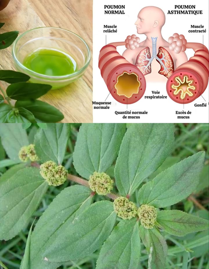 Euphorbia hirta : la plante alliée contre lasthme et bien plus encore
Utilisée depuis des générations, cette herbe médicinale offre de puissants bienfaits naturels.

1 Soutien respiratoire
 En infusion, elle aide à soulager lasthme et la bronchite en relaxant les bronches.

2 Bienfaits digestifs
 La décoction de feuilles calme diarrhée et spasmes intestinaux.

3 Soins de la peau
 En pâte, les feuilles écrasées traitent verrues, boutons et éruptions.

4 Action antimicrobienne
 Utile contre infections bactériennes, fongiques ou virales, en usage interne ou externe.

5 Antidouleur et anti-inflammatoire
 En cataplasme ou en tisane, elle apaise maux de tête, douleurs articulaires et musculaires.

6 Effet fébrifuge
 Une infusion de feuilles aide à faire baisser la fièvre.

7 Troubles urinaires
 En décoction, elle stimule la diurèse et soutient les voies urinaires.

𥳐 Comment lutiliser
 Tisane : faire bouillir les feuilles fraîches ou séchées quelques minutes
 Application locale : écraser les feuilles en pâte et appliquer sur la peau

 Toujours demander lavis dun professionnel de santé avant usage, notamment en cas de grossesse, dallaitement ou de pathologie chronique.

 Une plante discrète mais puissante, à intégrer avec précaution dans votre routine bien-être naturelle.
