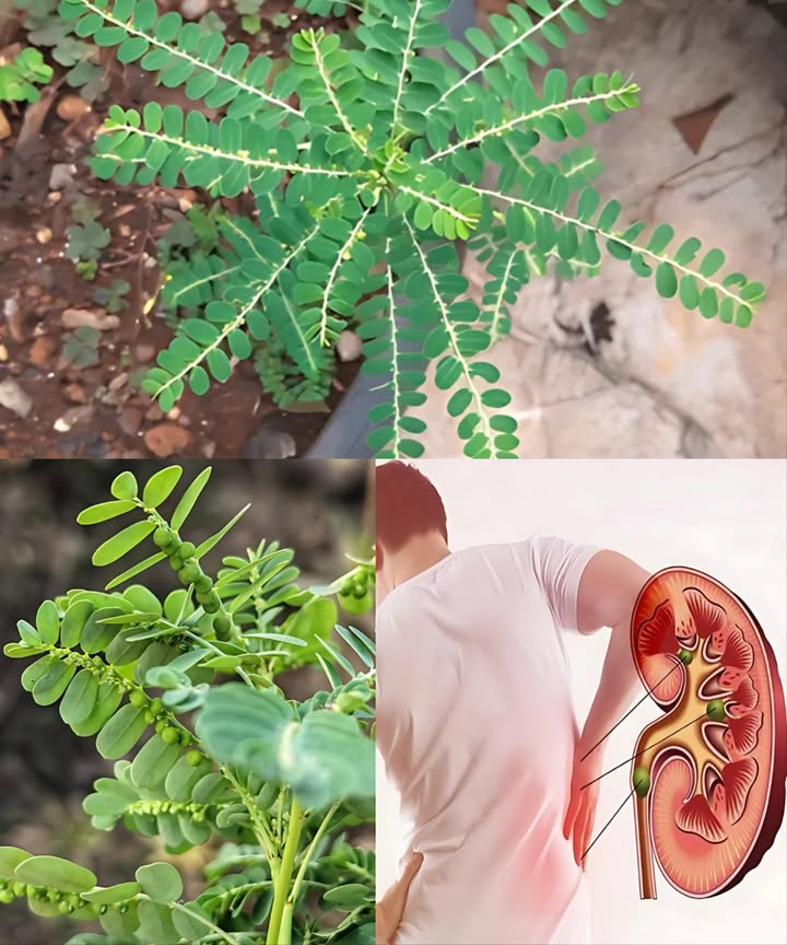 Phyllanthus niruri : la plante broyeuse contre les calculs rénaux
Un remède naturel ancestral aux puissants effets dissolvants et diurétiques.

1 Infusion purifiante
 1 c. à café de feuilles séchées / 1 tasse deau
 Faire bouillir 10 min, filtrer, boire 2 à 3 fois par jour pendant 2 semaines

2 Jus frais
 Mixer les feuilles fraîches avec de leau
 Filtrer et consommer 1 c. à soupe 2 fois par jour

3 Poudre maison
 Sécher puis réduire les feuilles en poudre fine
 Mélanger 1 c. à café dans de leau, du thé ou un jus chaque jour

 Précautions dusage
 Éviter en cas de grossesse ou dallaitement sans avis médical
 Ne pas dépasser les doses pour éviter la déshydratation

 Une plante puissante à intégrer en cure pour aider à prévenir et éliminer naturellement les petits calculs rénaux.