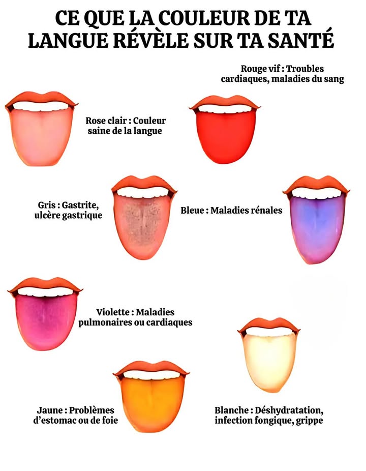 Ce que la couleur de ta langue révèle sur ta santé 喙

 Rouge vif
Peut indiquer un trouble cardiaque ou sanguin. À surveiller de près avec un professionnel de santé.

 Rose clair
Langue saine et équilibrée. Continue à thydrater et à prendre soin de toi.

 Grisâtre
Signe possible de gastrite ou dulcère. Attention à ta flore intestinale.

 Bleue
Souvent liée à un dysfonctionnement rénal. Un signal rare mais sérieux.

 Violette
Peut refléter des troubles pulmonaires ou cardiaques. Mieux vaut consulter.

 Blanchâtre
Fréquent en cas de grippe, mycose ou déshydratation. Bois plus deau et surveille lévolution.

 Jaune
Peut révéler des déséquilibres digestifs, estomac ou foie. Un bilan peut simposer.

 Ta langue parle pour ton corps
Un simple coup dœil peut prévenir de nombreux maux.
Reste attentif, et nhésite pas à consulter pour un avis fiable.