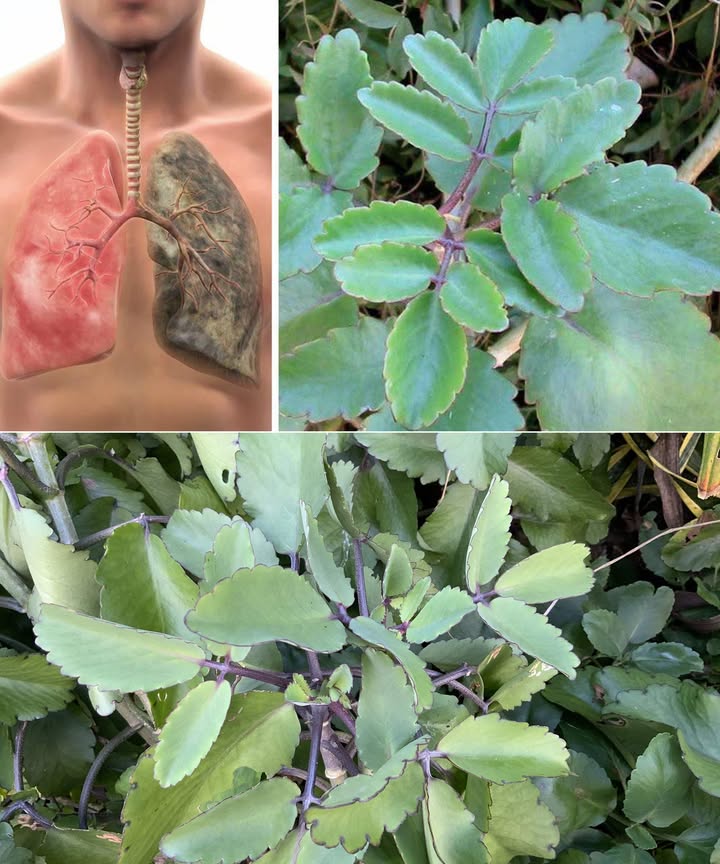 11 Bienfaits Surprenants de la Feuille Miracle de Vie 

1 Santé respiratoire  Infusion de feuilles pour soulager asthme et toux.
2 Cicatrisation  Cataplasme de feuilles broyées pour accélérer la guérison.
3 Antivirale & antibactérienne  Aide à combattre herpes et infections comme E. coli.
4 Anti-inflammatoire  Réduit linflammation en cas darthrite.
5 Santé digestive  Infusion apaisante contre douleurs destomac et troubles intestinaux.
6 Prévention des calculs rénaux  Lextrait de feuilles favorise leur dissolution.
7 Renfort immunitaire  Stimule les défenses naturelles de lorganisme.
8 Beauté de la peau  Traite acné et eczéma grâce à son extrait.
9 Soulagement de la douleur  Diminue les symptômes darthrite et les douleurs musculaires.
 Régulation du sucre  Aide à stabiliser la glycémie, bénéfique pour les diabétiques.
11 Santé cardiovasculaire  Favorise la baisse de la tension et du cholestérol.

 Remède naturel aux multiples vertus, mais toujours à utiliser avec prudence et avis médical préalable.