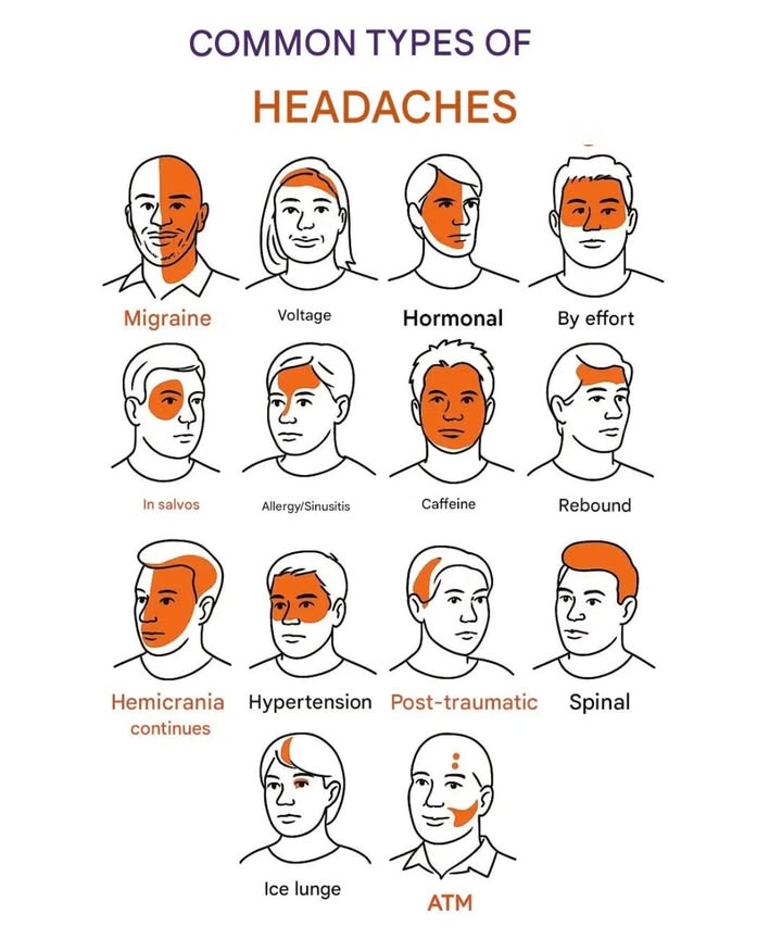 15 Common Types of Headaches  Where and How Do They Hurt?

1 Migraine  Throbbing pain on one side, usually near the eye.
2 Tension headache  Tight pressure on the forehead and back of the head.
3 Hormonal  Side pain linked to menstrual cycle changes.
4 Exertion headache  Full-head pain after intense physical activity.
5 Cluster headache  Sharp pain around one eye, occurring in cycles.
6 Sinus/allergy  Pressure in the cheeks, eyes, and forehead.
7 Caffeine-related  Pain in the temples and forehead from too much or withdrawal.
8 Rebound headache  General pain caused by overuse of painkillers.
9 Hemicrania continua  Ongoing pain on one side of the head.
 Hypertension headache  Pressure behind the head and on both sides.
11 Post-traumatic  Localized pain after a head injury.
12 Spinal headache  Neck pain due to spinal fluid pressure changes.
13 Thunderclap headache  Sudden, intense pain  medical emergency.
14 Ice pick headache  Sharp stabbing pain in a single spot.
15 TMJ jaw  Pain in the temple and jaw joint.
