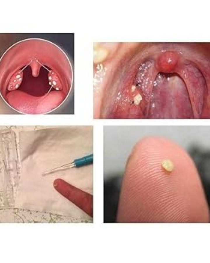 龍 Gingembre  Laurier  Ail : le trio naturel qui booste ta santé comme jamais !