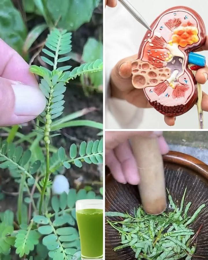 La plante miracle pour vos reins 

1 Cette petite herbe aux feuilles délicates est souvent arrachée comme une mauvaise herbe… et pourtant, elle est un vrai trésor pour la santé des reins.

2 En infusion ou en jus vert, elle aide à soutenir le système urinaire et à réduire linconfort lié aux calculs rénaux. Beaucoup de gens la jettent sans savoir quelle cache un secret puissant.

3 Facile à utiliser : il suffit décraser quelques feuilles fraîches, de les infuser dans de leau chaude ou de préparer un jus maison. Un geste simple qui peut faire une grande différence.

4 Erreur courante : certains pensent quil faut en consommer en grande quantité pour voir un effet. En réalité, la modération est la clé, car même les remèdes naturels doivent être utilisés avec équilibre.

 Avez-vous déjà croisé cette plante dans votre jardin sans savoir quelle pouvait protéger vos reins ?