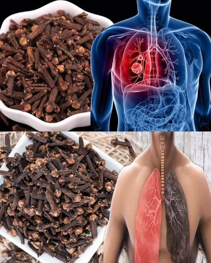 Clous de Girofle, Cannelle & Laurier : Ce “Remède” Maison Serait 200 Plus Puissant Quun Antibiotique ?