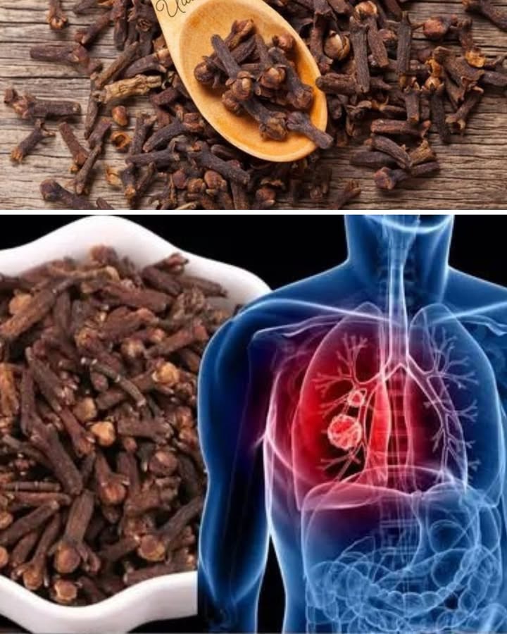 Clou de girofle : un secret naturel pour nettoyer les poumons et mieux respirer 

1 Le clou de girofle, cette petite épice au parfum puissant, agit comme un véritable purifiant pour les voies respiratoires. Grâce à ses propriétés antiseptiques et expectorantes, il aide à éliminer le mucus accumulé dans les poumons et à dégager les bronches naturellement.

2 Pour en profiter, fais bouillir cinq ou six clous de girofle dans une tasse deau pendant dix minutes. Laisse tiédir, puis bois cette infusion deux fois par jour. Elle aide à calmer la toux et à libérer la respiration.

3 En inhalation, cest tout aussi efficace ! Ajoute quelques clous de girofle dans un bol deau bouillante, couvre ta tête dune serviette et respire profondément la vapeur pendant quelques minutes. Cest un excellent moyen dassainir les poumons et de soulager la congestion.

4 Le clou de girofle agit aussi comme un puissant anti-inflammatoire. Il apaise les irritations de la gorge et réduit la sensation de brûlure provoquée par la toux ou la fumée.

5 Petit rappel utile : même naturel, le clou de girofle est très concentré. Ne dépasse pas deux tasses dinfusion par jour, et évite-le si tu es enceinte ou sujet à des brûlures destomac.

Utilisé avec modération, ce trésor des cuisines devient un allié précieux pour des poumons propres et un souffle léger.