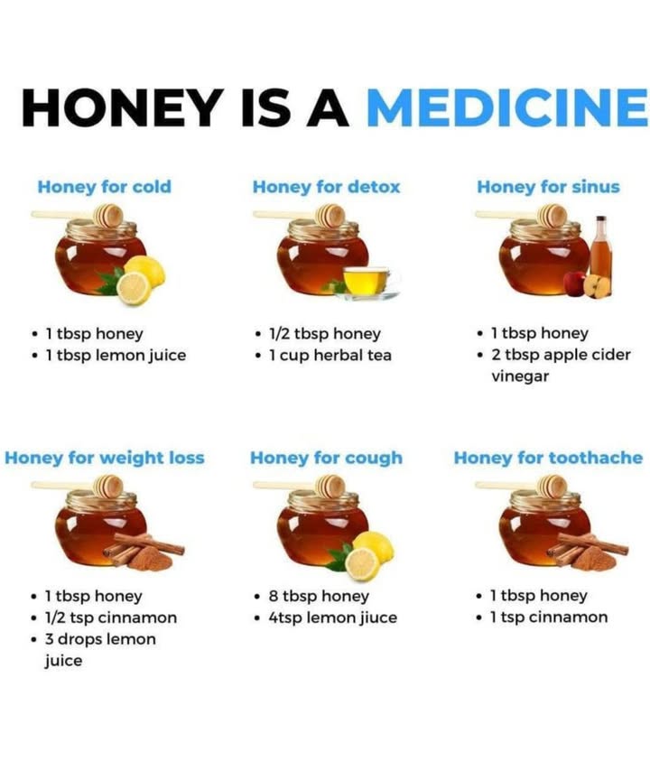 Honey is Medicine!  Sweet Remedies for Common Ailments!
蠟 For Colds
Mix: 1 tbsp honey  1 tbsp lemon juice
 Soothes sore throats & boosts immunity with Vitamin C

 For Detox
Mix:  tbsp honey  1 cup herbal tea
 A gentle daily cleanse to support natural detoxification

 For Sinus Relief
Mix: 1 tbsp honey  2 tbsp apple cider vinegar
 May help loosen mucus and reduce congestion

律 For Weight Loss Support
Mix: 1 tbsp honey   tsp cinnamon  3 drops lemon juice
 Boosts metabolism & curbs cravings as part of a healthy diet

 For Coughs
Mix: 8 tbsp honey  4 tsp lemon juice
 A time-tested natural cough remedy to soothe irritation

 For Toothaches
Mix: 1 tbsp honey  1 tsp cinnamon
醴 Anti-inflammatory & antibacterial  may offer short-term relief
Always consult a dentist for ongoing pain!

 Why Honey Heals:
Honey is:
 Antibacterial
 Anti-inflammatory
 Antioxidant-rich
 Naturally soothing

Perfect for your wellness cabinet and your beauty routine!