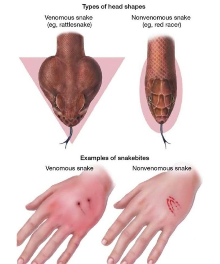 Snake Smarts!  How to Identify Venomous vs. Nonvenomous Snakes & Their Bites!
 Snake ID: Head Shapes & Bite Clues!
易 Head Shape Hints
Venomous Snakes like Rattlesnakes:
 Often have a triangular or spade-shaped head, wider than the neck  due to venom glands.
 But beware: Some nonvenomous snakes mimic this shape by flattening their heads!

Nonvenomous Snakes like Red Racers:
 Usually have a rounded or oval head that blends into the body, without much distinction.

喝 Bite Mark Breakdown
 Venomous Bites:
Look for 12 deep puncture marks fangs

Swelling, redness, and severe pain may follow fast
 Seek emergency care immediately!

 Nonvenomous Bites:
Appear as multiple small teeth marks in a U-shape

Less painful but clean thoroughly to prevent infection

 Safety Tips to Remember:
Always keep your distancedont approach or handle!

Dont rely solely on head shape or behavior to judge danger

If bitten, stay calm and note the snakes appearance from a safe distance! for medics