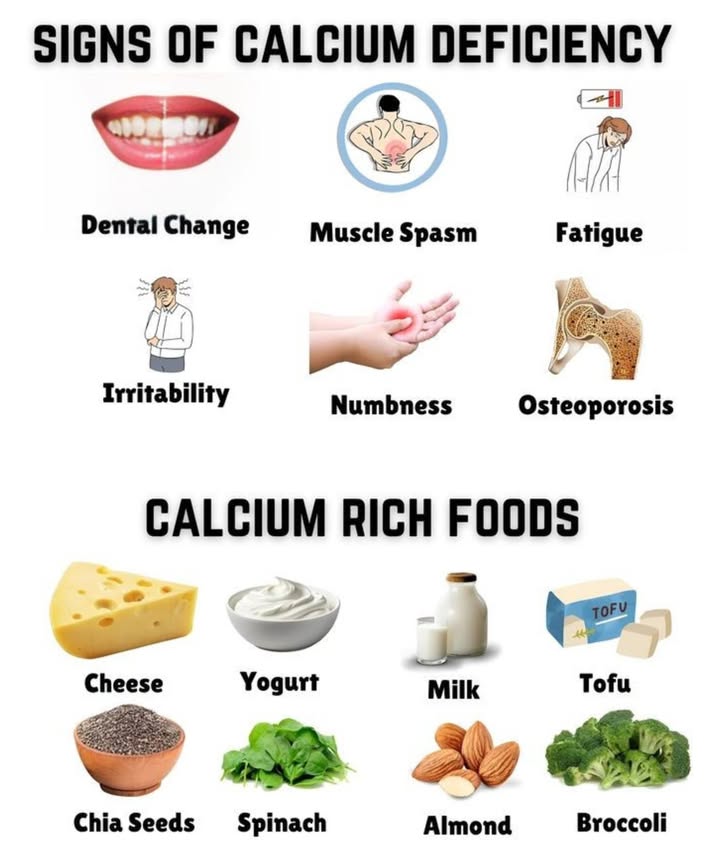 領 Dont Ignore These Signs! Is Your Body Lacking Calcium? 拏
 Common Signs of Calcium Deficiency:
 Dental Changes  Weak or decaying teeth

 Muscle Spasms  Sudden cramps or twitching

 Fatigue  Always feeling tired or low energy

 Irritability  Mood swings or feeling on edge

爐 Numbness  Tingling or reduced sensation in hands/feet

領 Osteoporosis  Bone thinning & fracture risk

復 Top Calcium-Rich Foods to Add to Your Diet:
燎 Cheese  Delicious and calcium-packed
北 Yogurt  Great for digestion and bones
拏 Milk  Classic go-to for calcium and vitamin D
 Tofu  A plant-based powerhouse
 Chia Seeds  Tiny but mighty in nutrients
塞 Spinach  Leafy green with bonus iron
樂 Almonds  Crunchy snack full of calcium
復 Broccoli  Great for bones and overall health

 Tip: Pair calcium-rich foods with vitamin D like sunshine or eggs to help your body absorb it better!