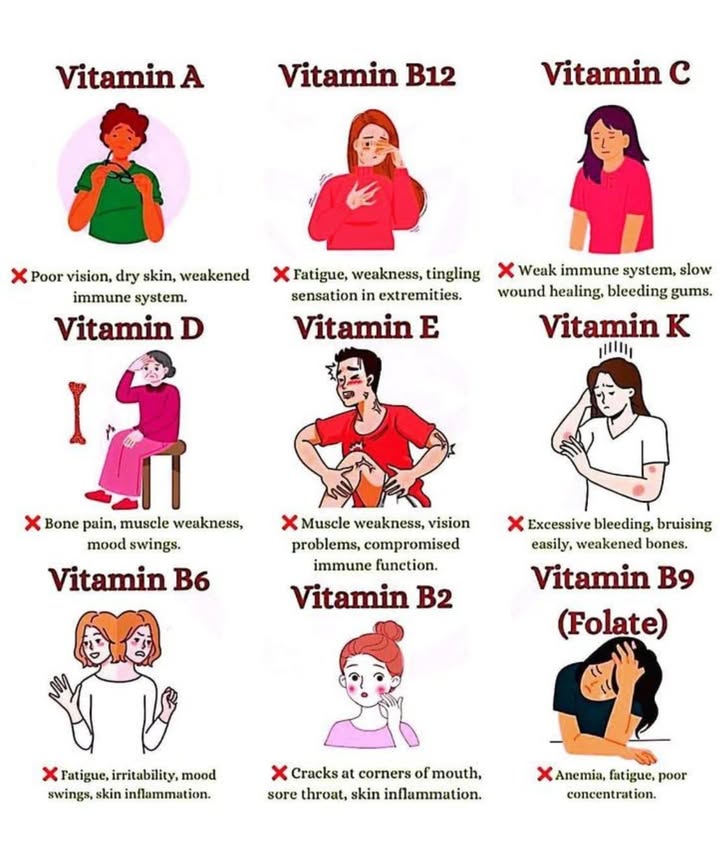 Signs Youre Lacking Essential Vitaminsand What They Mean
凌 Vitamin A
 Symptoms:
 Poor night vision
 Dry, flaky skin
 Getting sick often

 Why It Matters:
Boosts vision, skin health & immunity.

 Vitamin B12
 Symptoms:
 Tired all the time
 Tingling in hands/feet
 Brain fog or mood swings

 Why It Matters:
Vital for nerves & red blood cell production.

 Vitamin C
 Symptoms:
 Frequent colds
 Cuts heal slowly
 Bleeding gums

 Why It Matters:
Strengthens immunity & collagen for healthy skin.

 Vitamin D
 Symptoms:
 Bone aches
 Muscle fatigue
 Low mood or depression

 Why It Matters:
Helps your body absorb calcium & supports mood.

樂 Vitamin E
 Symptoms:
 Muscle weakness
 Blurry vision
 Getting sick more often

 Why It Matters:
An antioxidant that protects your cells & immune system.

塞 Vitamin K
 Symptoms:
 Easy bruising
 Bleeding a lot from small cuts
 Brittle bones

 Why It Matters:
Essential for blood clotting and bone health.

易 Vitamin B6
 Symptoms:
 Fatigue
 Mood swings or irritability
 Skin issues

 Why It Matters:
Supports brain and immune health.

 Vitamin B2 Riboflavin
 Symptoms:
 Cracked mouth corners
 Sore throat
 Skin inflammation

 Why It Matters:
Converts food to energy and keeps skin/eyes healthy.

溺 Vitamin B9 Folate
 Symptoms:
 Anemia
 Constant tiredness
 Trouble focusing

 Why It Matters:
Critical for cell growth & red blood cell formation.