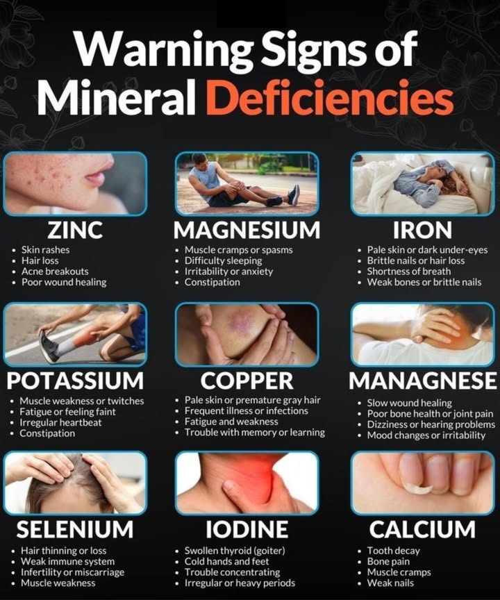Are You Lacking Key Minerals? 樂 9 Warning Signs Your Body Might Be Sending!
林 ZINC Deficiency

Skin rashes or acne

Hair loss

Poor wound healing

 MAGNESIUM Deficiency

Muscle cramps or spasms

Trouble sleeping

Anxiety or irritability

Constipation

 IRON Deficiency

Pale skin or dark circles

Brittle nails/hair

Fatigue or breathlessness

 POTASSIUM Deficiency

Muscle weakness or twitching

Fatigue or faintness

Irregular heartbeat

Constipation

易 COPPER Deficiency

Pale skin or early gray hair

Frequent infections

Fatigue

Memory or learning issues

領 MANGANESE Deficiency

Joint pain or bone problems

Slow healing

Dizziness

Mood swings

 SELENIUM Deficiency

Hair thinning

Weak immunity

Fertility struggles

Muscle fatigue

流 IODINE Deficiency

Swollen thyroid goiter

Cold hands & feet

Brain fog

Irregular/heavy periods

醴 CALCIUM Deficiency

Tooth decay

Bone aches

Muscle cramps

Weak or brittle nails

 What to Do If These Sound Familiar:
綾 Focus on whole foods like leafy greens, nuts, seeds, legumes, seafood, and dairy.
 Supplement only if neededand always under medical advice.